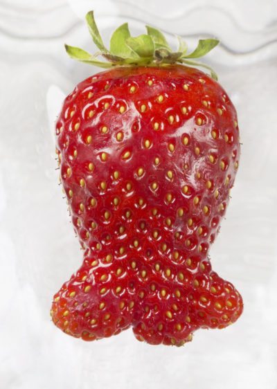 strawberry deformity