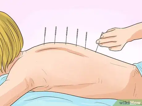 Image titled Treat Rheumatoid Arthritis Naturally Step 7