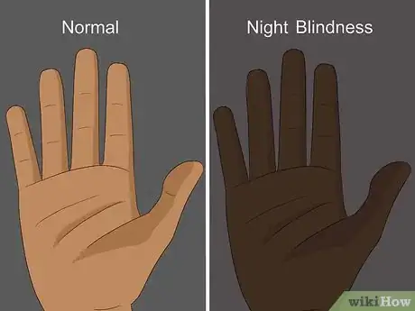 Image titled Find Out if You Have a Vitamin Deficiency Step 10