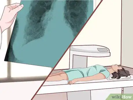 Image titled Test for Whooping Cough Step 6