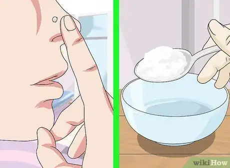 Image titled Get Rid of a Nose Ring Bump Step 7