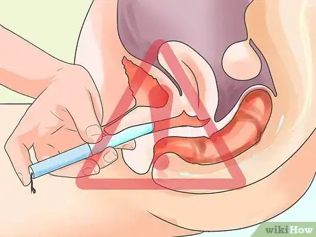 Image titled Know if You Have Toxic Shock Syndrome Step 7