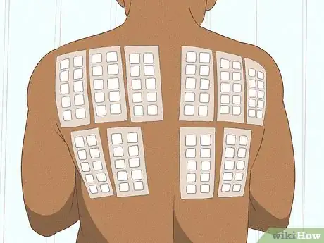 Image titled Improve Eczema with Diet Step 5