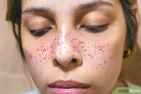 Image titled Do Glitter Freckles Step 10