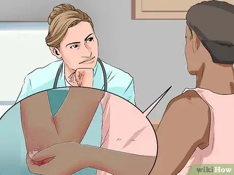 Image titled Prevent Squamous Cell Skin Cancer Step 14