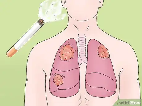 Image titled Delay Gratification Step 10