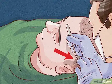 Image titled Deal with Bald Spots Step 5