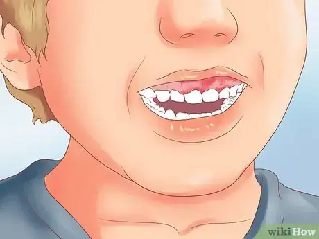 Image titled Prevent Leukemia in Children Step 12