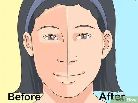 Image titled Prevent Vitiligo Step 16