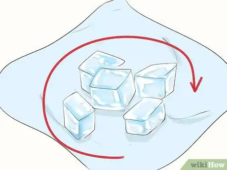 Image titled Do Skin Icing Step 3