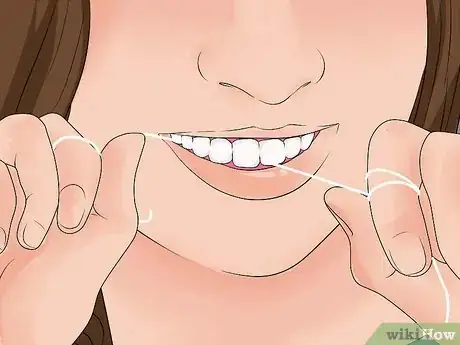 Image titled Avoid Getting Braces Step 9
