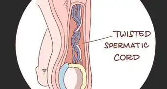 Treat Pain and Swelling in the Testicles