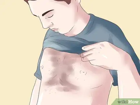 Image titled Recognize the Symptoms of Neuromata Step 16