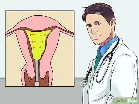 Image titled Get Rid of Uterine Fibroid Pain Step 14