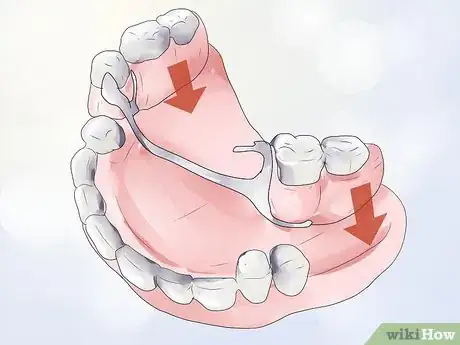 Image titled Handle Tooth Loss Step 1
