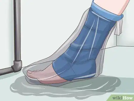 Image titled Treat a Growth Plate Fracture Step 6