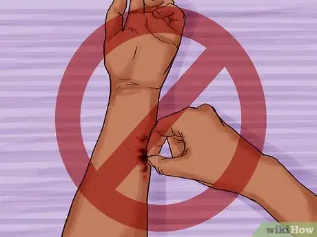 Image titled Care for a Tattoo During Removal Step 9