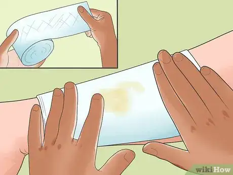 Image titled Know if You Have Toxic Shock Syndrome Step 9