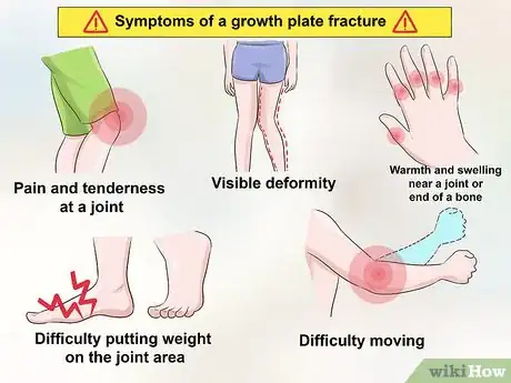 Image titled Treat a Growth Plate Fracture Step 1