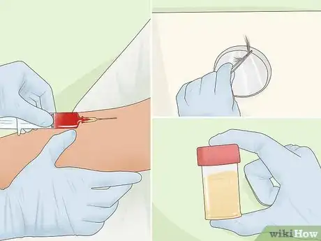 Image titled Treat Heavy Metal Toxicity Step 11.jpeg