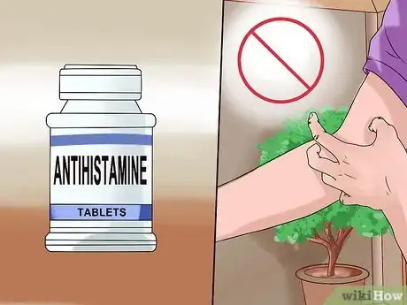 Image titled Treat Winter Eczema Step 12