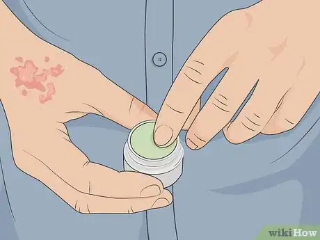 Image titled Take CBD Oil for Psoriasis Step 06