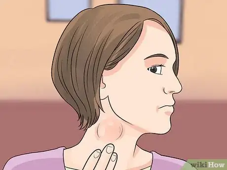 Image titled Recognize and Prevent Rubella (German Measles) Step 3