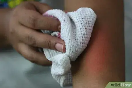 Image titled Soothe Bites and Stings with Vodka Step 9