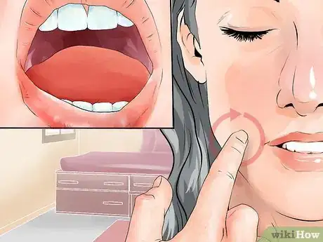 Image titled Treat TMJ Pain Step 5