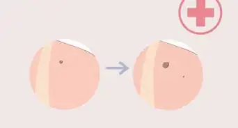 Get Fair Skin Naturally