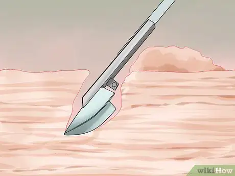 Image titled Dig Pacific Razor Clams Step 5