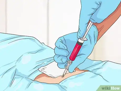 Image titled Diagnose Multiple Myeloma Step 10