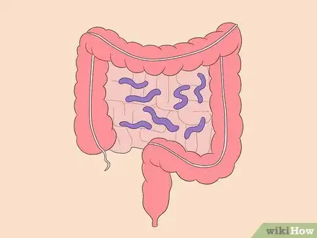 Image titled Treat Campylobacter Step 1