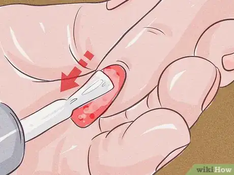 Image titled Give Someone a Manicure Step 11