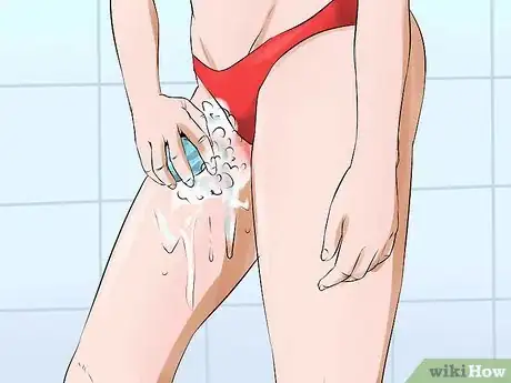 Image titled Get Rid of a Rash Between Your Legs Step 6