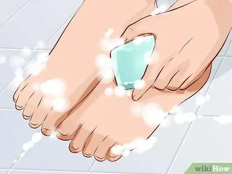 Image titled Treat Trench Foot Step 2