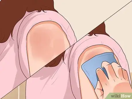 Image titled Determine the Side Effects of an MMR Vaccination Step 1