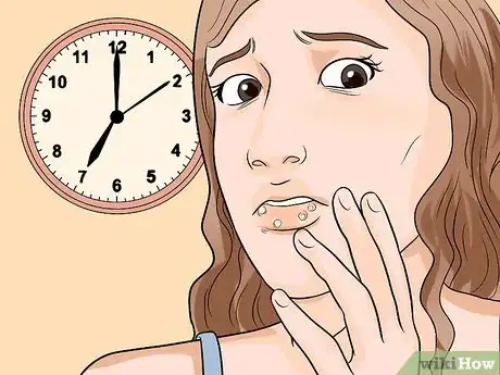 Image titled Recognize Herpes Step 3