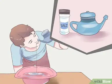 Image titled Cure Nasal Polyps Step 5