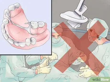 Image titled Handle Tooth Loss Step 3