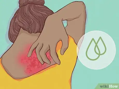 Image titled What Causes Skin to Be Sensitive Step 4
