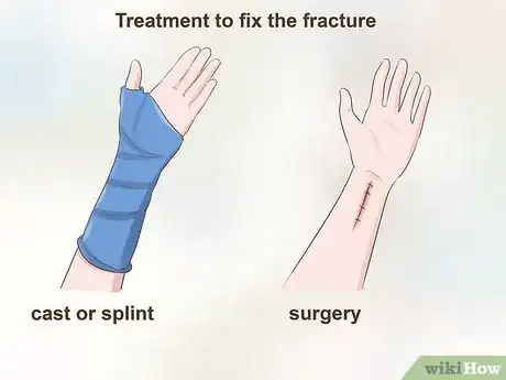 Image titled Treat a Growth Plate Fracture Step 5