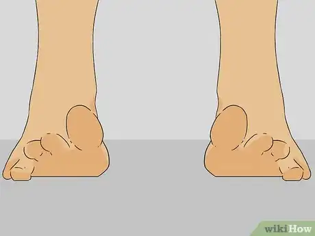 Image titled Exercise Toes Step 1