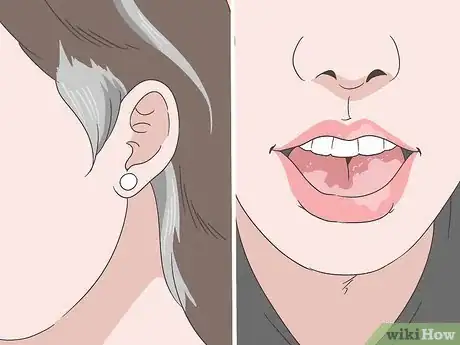 Image titled Diagnose and Treat Facial Vitiligo Step 2