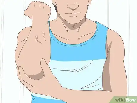 Image titled Treat Arthritis Naturally Step 16