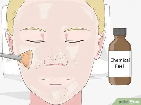 Image titled Clean Clogged Pores Step 4