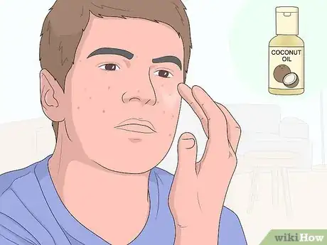 Image titled Get Rid of Acne Scars at Home Without Chemicals Step 4