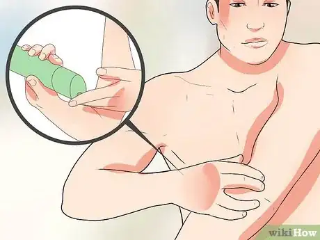 Image titled Cure Cracked and Dry Elbows Step 1