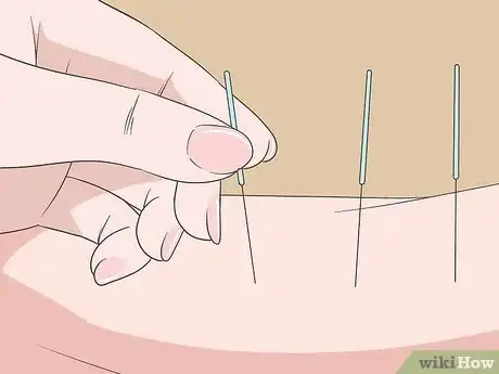 Image titled Treat Depression Naturally Step 7