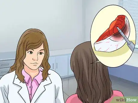 Image titled Survive Cataract Surgery Step 6